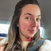 Zoë